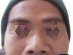 Biadap, Seorang Ayah Tega Menyiksa Putri Kandungnya yang Berusia 5 Tahun